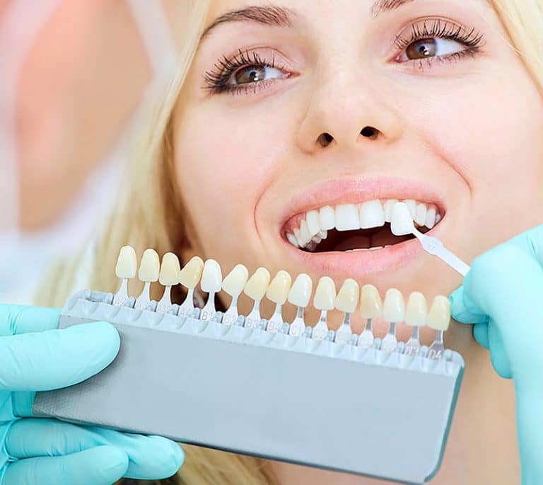 Dental Checkup Toronto | Dental Clinic | Galleria Dental
